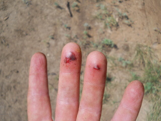 Fingers After Grabbing Moving Circular Saw Blade